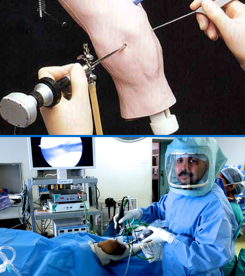 Arthroscopic Surgery Arthroscopy Surgery In Krishna Nagar East Delhi 